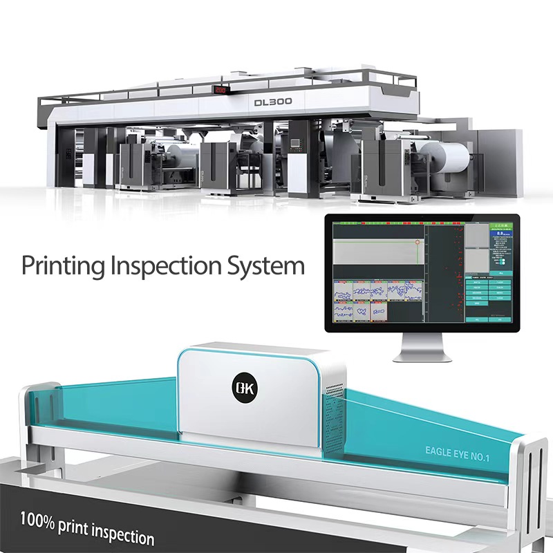 100% printing inspection system